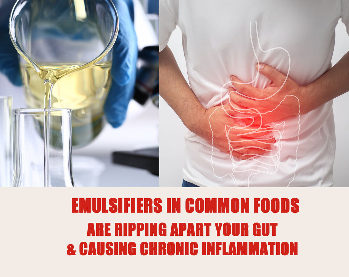 The Role of Ultra-Processed Foods in Neurodegeneration