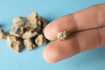 The Kidney Stone Diet Disaster: Which  Popular Diet is causing Kidney Stones & Kidney Disease and How to Stay Stone-Free